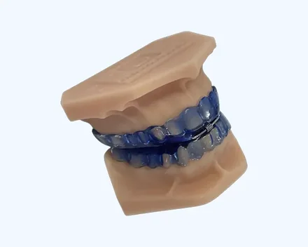 Conjunto montado sobre o modelo da arcada, visto em perspectiva