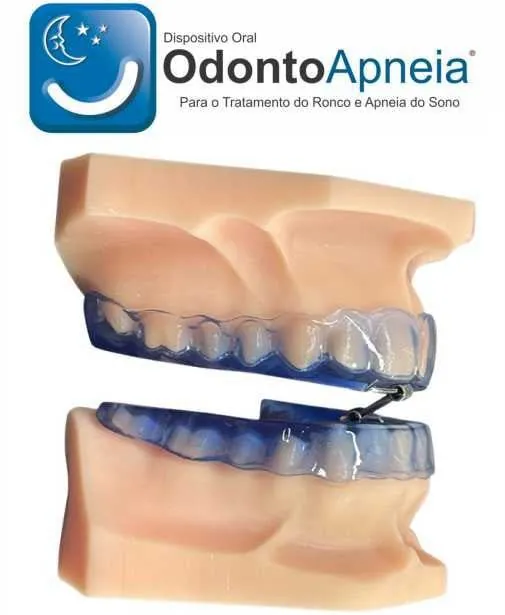 Aparelho Intraoral para Apneia do Sistema Odontoapneia, com as duas placas encaixadas no modelo